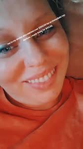 Dentures for Women Jesse Dent