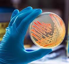 Image result for CSF Culture