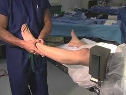 Arthroscopic Knee Surgery Video Part 1 Knee Positioning New Mexico Knee Specialist Dr Lubowitz Youtube