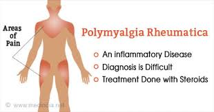 Image result for Polymyalgia Rheumatica