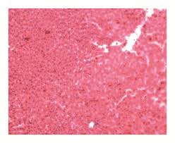 Image result for Pseudospondias