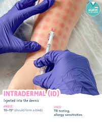 Image result for Subcutaneous Injection