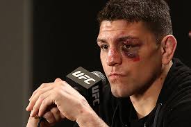On july 13, diaz has signed an agreement to face robbie lawler at ufc 266 on. Nick Diaz Vs Robbie Lawler To Be Five Round Non Title Bout At Ufc 266