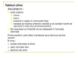Lo que tenemos que hacer es esto: MalformaÅ£ii Congenitale De Cord La Copii Ppt Katebasma