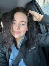 One month pre surgery and 5 months post op ❤️ best decision ever