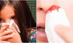 Faktor cuaca yang tidak menentu seperti panas terik adalah antara punca utama mengapa kita sering demam, selsema dan batuk berpanjangan sehingga menyebabkan hidung tersumbat yang. Doktor Ini Jelaskan Punca Kenapa Selsema Anak Anda Berpanjangan Berbau Macam Tak Percaya