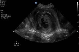 La poitrine se prépare à l'allaitement. Gestation De La Chienne Semaine Apres Semaine