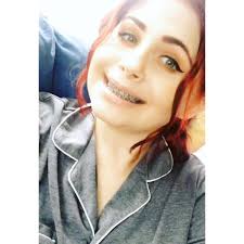 I have now had temporaries snap/ crack 3 times in 4 months. I believe this  is due to a bite correction which is not quite right. Each time lower jaw.  I am