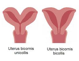 Image result for uterus