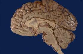 Neuroanatomy Tutorials From The Internet Pathology Laboratory For Medical Education Webpath Hosted By The Unive Human Body Systems Brain Facts Brain Issues