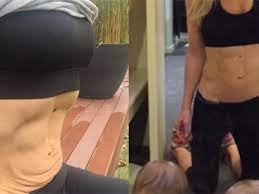 This Photo Shows That Loose Skin Is Normal After Giving Birth Even If You Have A Six Pack Self