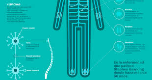 La causa de la ela de momento es desconocida. Ela Infografia De Saludgrafica Diseno De Informacion