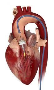 Tavi Fur Jeden Geeignet Healthcare In Europe Com