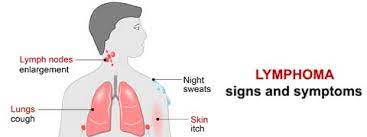 Researchers do not know the exact cause of hodgkin lymphoma. Lymphoma Causes Symptoms And Treatment Netmeds