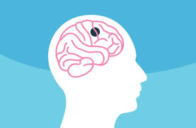 How are these tumors diagnosed? Why A Brain Tumor Does Not Always Mean You Have Cancer Health Essentials From Cleveland Clinic