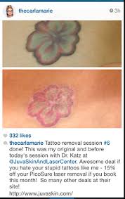 Carla Marie Who Has An Unwanted Tattoo And Wishes To Remove It Safely Quickly Has Been Very Happy With Her Tattoo Removal Tattoo Removal Cost Laser Tattoo