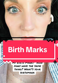 One of my 6 sisters… developed the same brown spot when ever she was in  middle school! We aren’t sure when I got mine… as I’m the oldest of 7 and I  guess it wasn’t noticed until I was able to notice ...