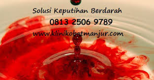 Keputihan merupakan suatu kondisi dimana keluarnya cairan lendir dari vagina. Cara Mengobati Keputihan Berdarah Obat Herbal De Nature Medium