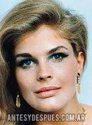 El Antes y Despues de Candice Bergen
