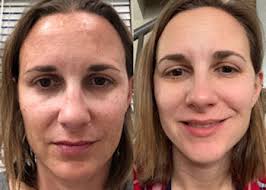 Spalons By Skin Bliss, 2345 124th Court NE, Blaine, MN USA