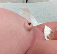 Image result for Umbilicus botryoides