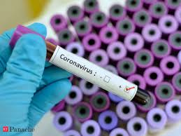 According to both studies, the first symptoms patients experience are a fever and a cough. Infection 14 Day Incubation Period Debunked Researchers Say Coronavirus May Start Showing Symptoms In 5 Days The Economic Times
