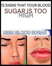 Signs of high blood sugar levels