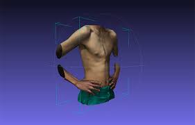 Maybe you would like to learn more about one of these? What Is Pectus Carinatum And How Can It Be Treated Braceworks Custom Orthotics