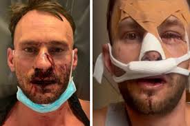 Spizz"-Club in Leipzig: Prügel-Opfer Robert Hebestreit sieht "keinen Grund,  dass es so ausgeartet ist"