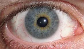 「オッドアイ」の画像検索結果