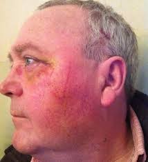 Axe attack in pub leaves brothers 'terrified of further attacks'