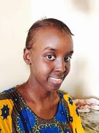 Abdullahi Hussein Abdullahi, MD (@abdullahi_doc)