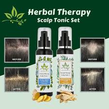If you want to keep your hair healthy and vibrant forever, make it a part of your hair care routine. Herbal Therapy Scalp Tonic Anti Dandruff Hair Loss Hair Fall Shampoo Natural Herbal Hair Care Deals For Only S 34 9 Instead Of S 45