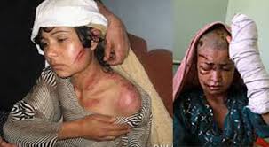 Image result for women abuse