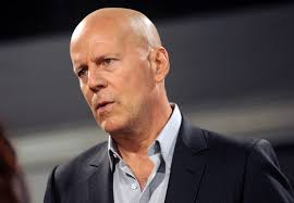Bruce Willis' Aphasia Concerned Directors Before Retirement