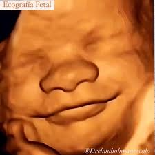 Este bebé parece estar feliz de ser reconocido y evaluado con nuestra  tecnología volumétrica del Samsung HS-40. Son imágenes que impactan y se  quedan.