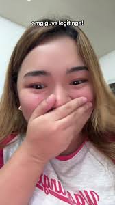 Does Handy Andy Remove Stretch Marks