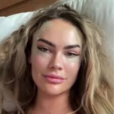 Amy Kenyon gets cosmetic surgery after her looks