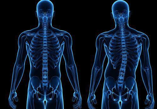 Chiropractic Therapy product image