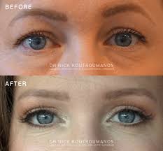 Cosmetic Treatments