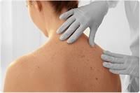 A mole scanner is a great technological aid in detecting early skin cancer. Mole Mapping