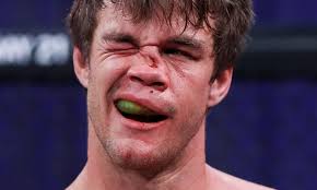 Snaps, Cracks and POPS 💥 When MMA Fights Go WRONG 😳