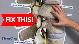 Maybe you would like to learn more about one of these? How To Fix A Bulging Disc In Your Lower Back Relief In Seconds Youtube