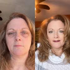 Brow shaping boosts confidence