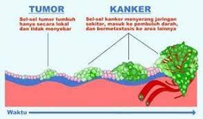 Pin Di Kumpulan Perbedaan Lengkap