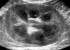 18 we recommend that the hpn formula be adjusted with the aim of normalizing laboratory tests. Chronic Kidney Disease Cornell University College Of Veterinary Medicine