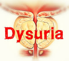 Image result for Dysuria