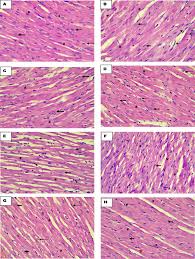 Image result for Hippocratea africana