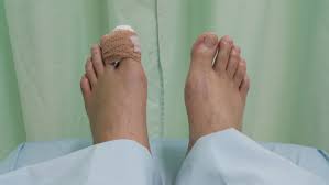 One way to know whether your toe is broken is if you can put weight on the foot. 15 Home Remedies To Relieve A Broken Toe