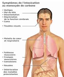 Sa densité est de 0,968 alors que celle de l'air est de 1. Le Monoxyde De Carbone Qu Est Ce Que C Est Quelle Protection